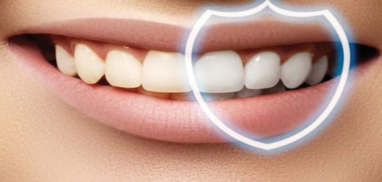 لمینت دندان زیباتر است یا کامپوزیت؟